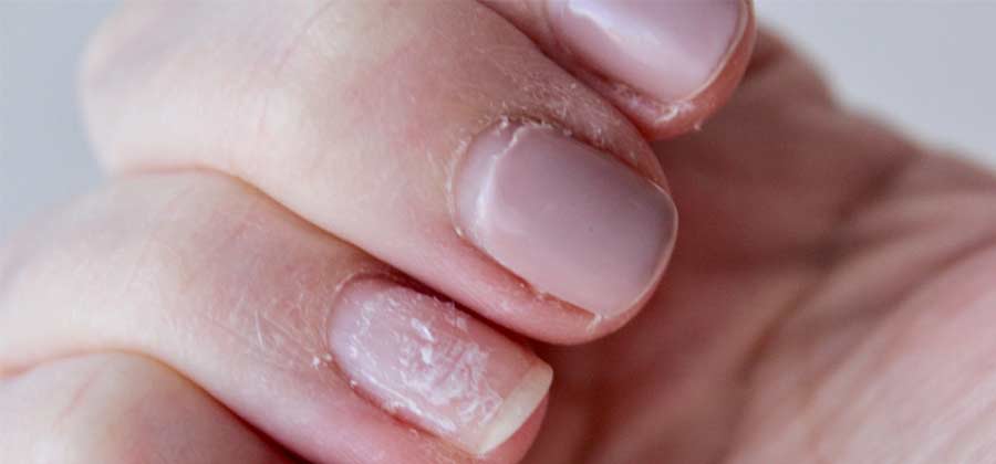 Cómo recuperar las uñas después de manicura permanente
