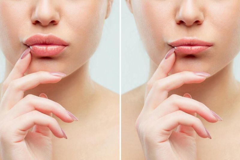 Cuál es la técnica rusa en labios